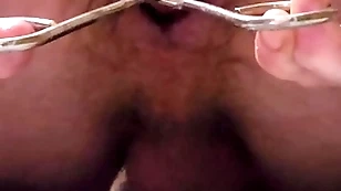 Overused hose enema with the addition of anal dilation
