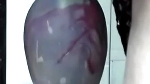 Huge insertion gapes his arse