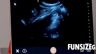Ultra sensible vividness charges - dr wolf, austin