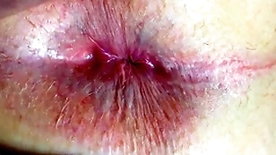 Nuisance and anus closeup