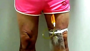 Catheter far collection sac away from pinky 396